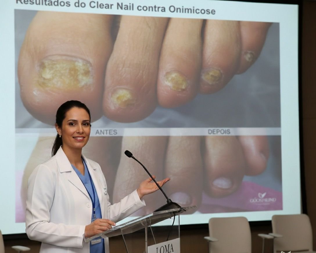 Dispositivo ClearNail UVLED