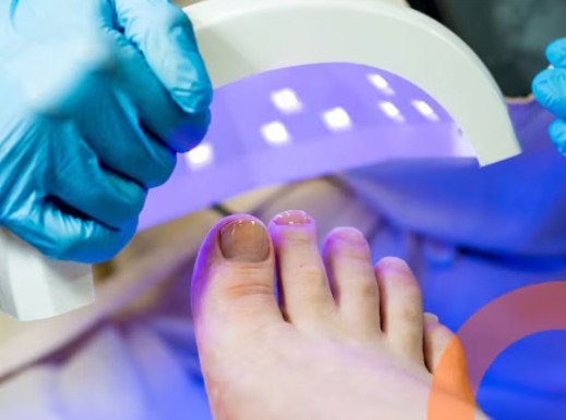 Dispositivo ClearNail em destaque